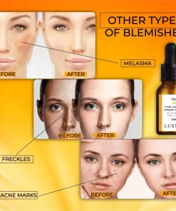 BlemishSkin Corrector Serum,Corrector serum