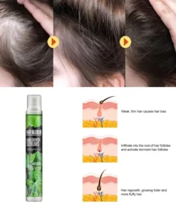 Hair Growth Essence Spray,Essence Spray,Hair Growth Essence