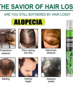 Hair Growth Essence Spray,Essence Spray,Hair Growth Essence