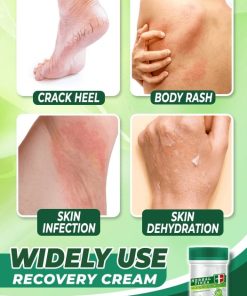 Herbal Tinea Corporis Cream,Tinea Corporis Cream,Corporis Cream