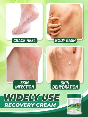 Herbal Tinea Corporis Cream,Tinea Corporis Cream,Corporis Cream
