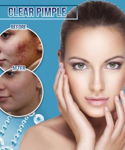 Miracle BlemishFree SkinCream