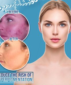 Miracle BlemishFree SkinCream