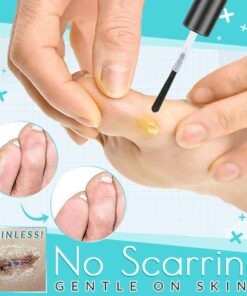 OneStep Corn Removal Gel