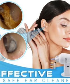 e-Clean Ear Wax Auto Vacuum Remover,e-Clean™ Ear Wax Auto Vacuum Remover