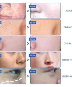 LED Face Mask,LED Face,Face Mask