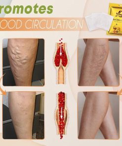Herbal Varicose Veins Detox Healing Patch,Healing Patch,Varicose Veins,Detox Healing Patch