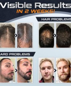 BioTech Advanced,Regrowth Treatment,Treatment Kit,Bio’Tech Advanced Regrowth Treatment Kit