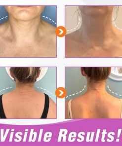 WonderDefined Back-Fat Burner Herbal Patch,WonderDefined™ Back-Fat Burner Herbal Patch,Herbal Patch