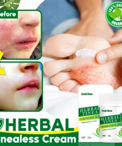 Tinea Cream,Herbal Tinealess Cream