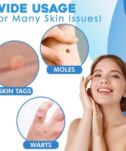 Tag Removal,Auto Tag,Auto Tag Removal Kit