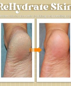 Anti Fungal Spray,Fungal Spray