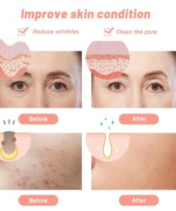 7 Colors LED Light Therapy Face Mask