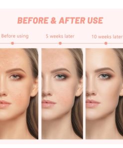 7 Colors LED Light Therapy Face Mask