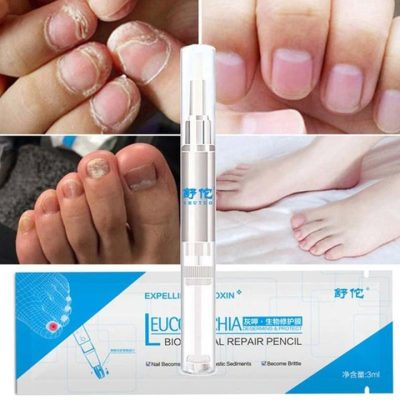 Nail Repair Pen