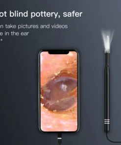 Endoscope Camera Ear Wax Removal