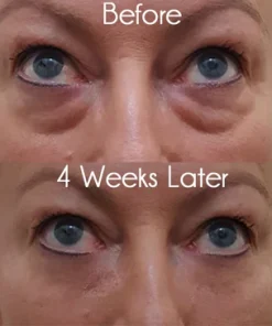 Pro Xylane Active Eye Cream