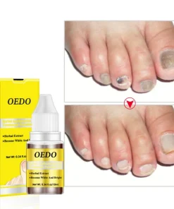 Herbal Nail Treatments Essential Oil