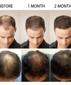 5 Days Ruvine Hair Essence