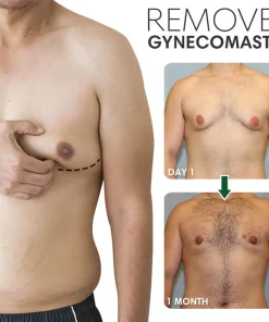 SoliPac Gynecomastia Reduction Ointment