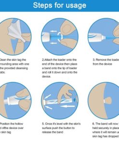 Auto Skin Tag Removal Kit