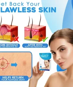 Auto Skin Tag Removal Kit