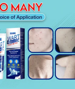 Instant Skin Tag Removal