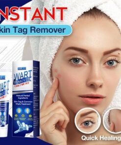 Instant Skin Tag Removal