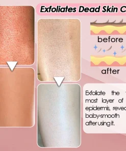 Silky Soft Skin Hair Remover