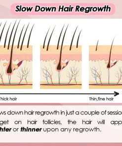 Silky Soft Skin Hair Remover