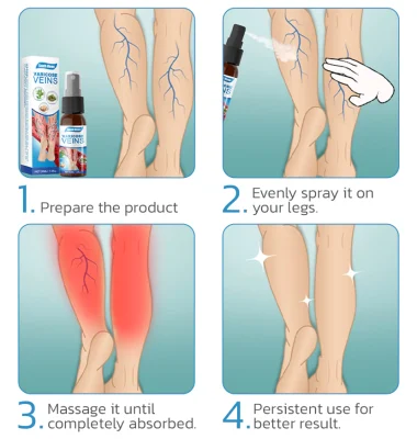 Varicose Veins Spray