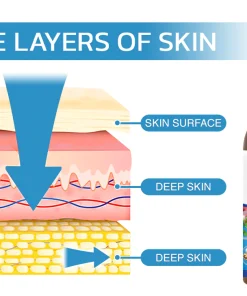 Varicose Veins Spray