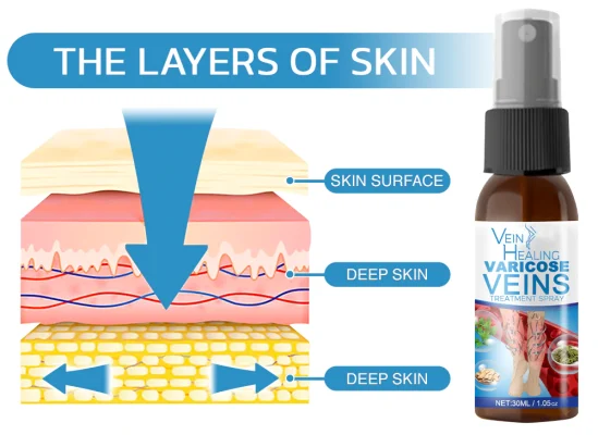 Varicose Veins Spray