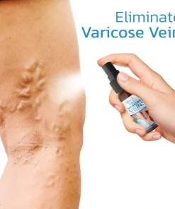 Varicose Veins Spray