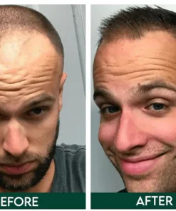 Botanical Hair Regrowth Essence