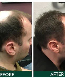 Botanical Hair Regrowth Essence