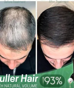 Regrowth Organic Hair Serum Roller