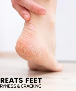 Intense Heel Moisturizing Stick