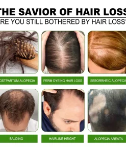 Hair Growth Nourishing Ginger Spray