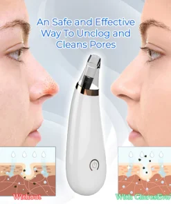 Pore Vacuum Cleaner For Blackheads