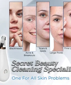 Pore Vacuum Cleaner For Blackheads