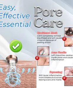Pore Vacuum Cleaner For Blackheads