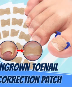 Ingrown Toenail Correction Patch