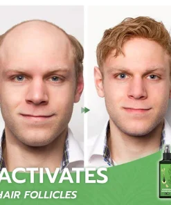 Hair Growth Nourishing Ginger Spray