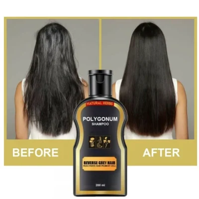 Natural Herbs Polygonum Shampoo