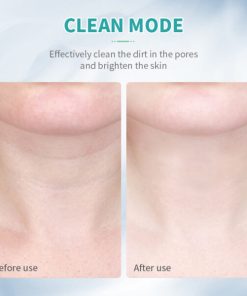 LED Face and Neck Lifting Massager