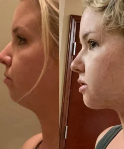 OdorFit Slimfast Aromatherapy Detox Breathe Stick