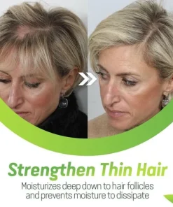 7X Rapid Hair Growth Serum