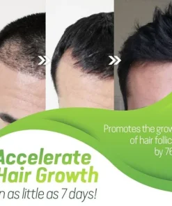 7X Rapid Hair Growth Serum