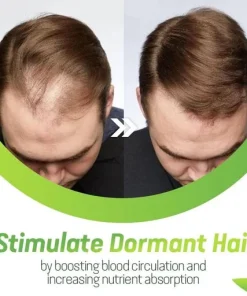 7X Rapid Hair Growth Serum